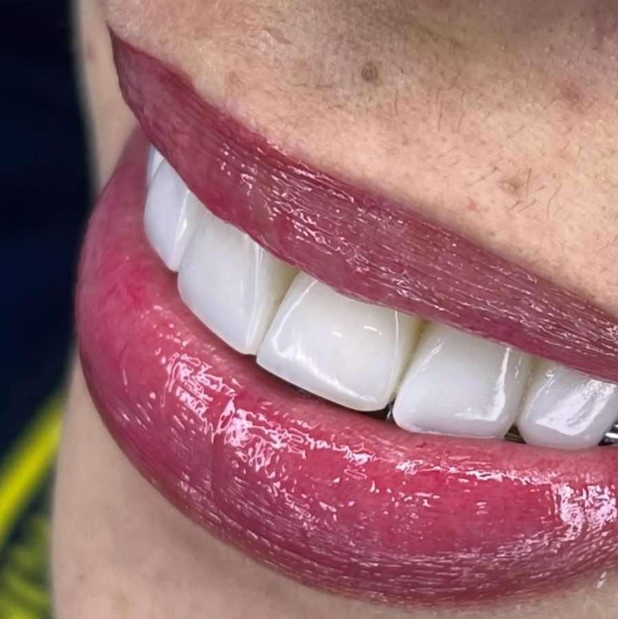 Facetas