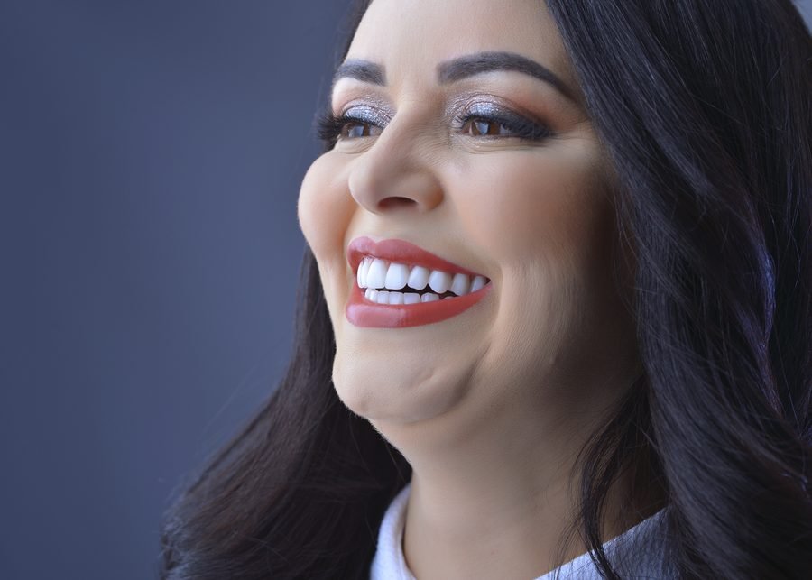 Implantes Dentários