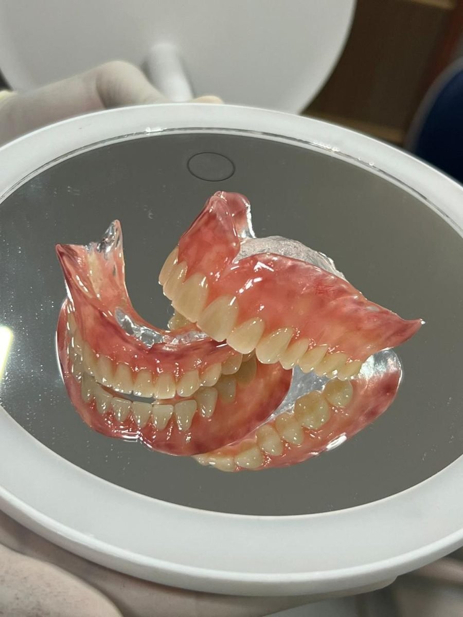 Prótese Dentária